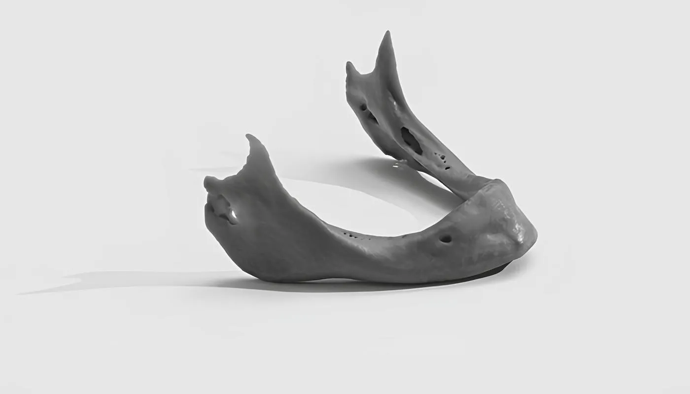 A jaw mandible used in surgery, made using SLA 3D printing