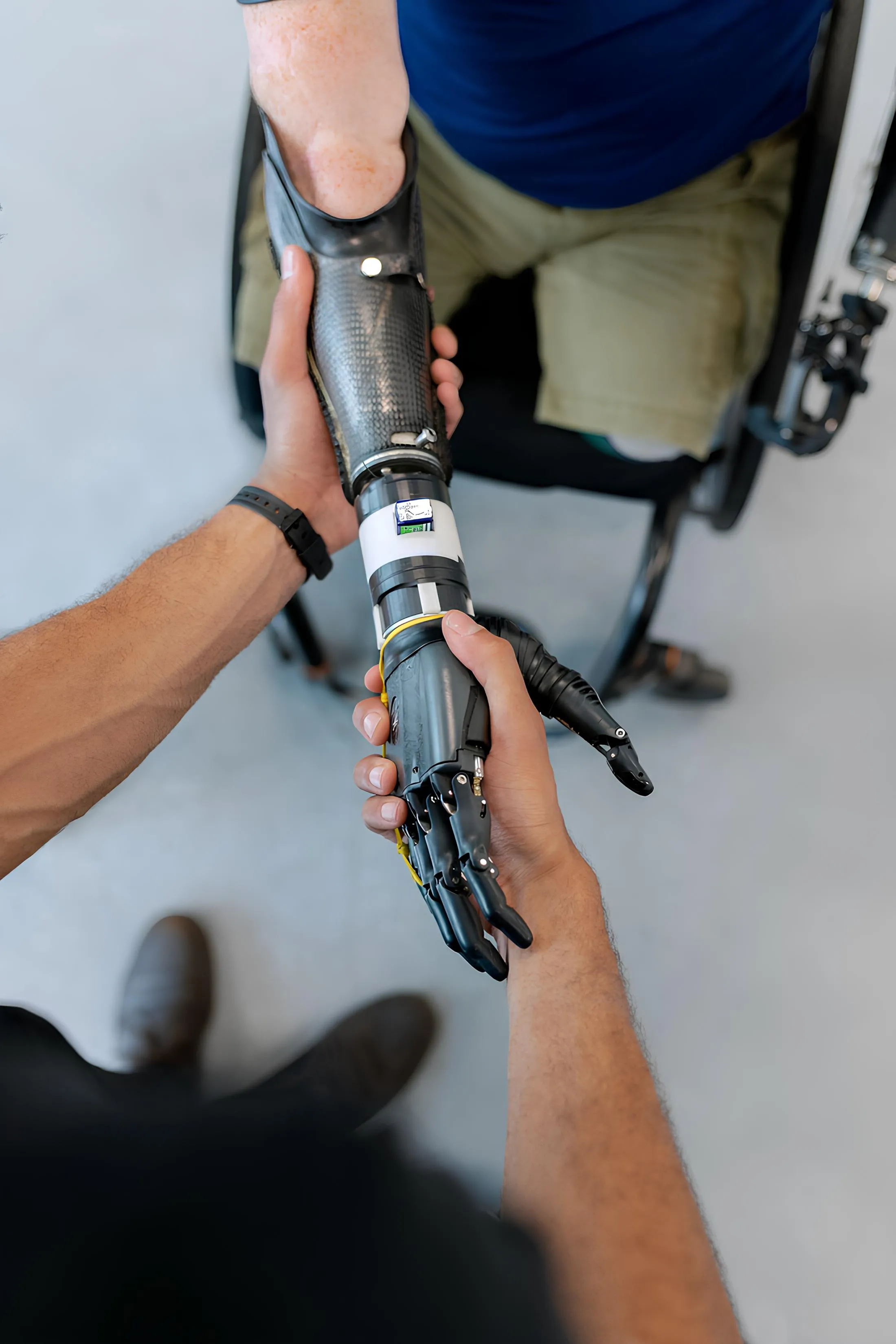 Prosthetics