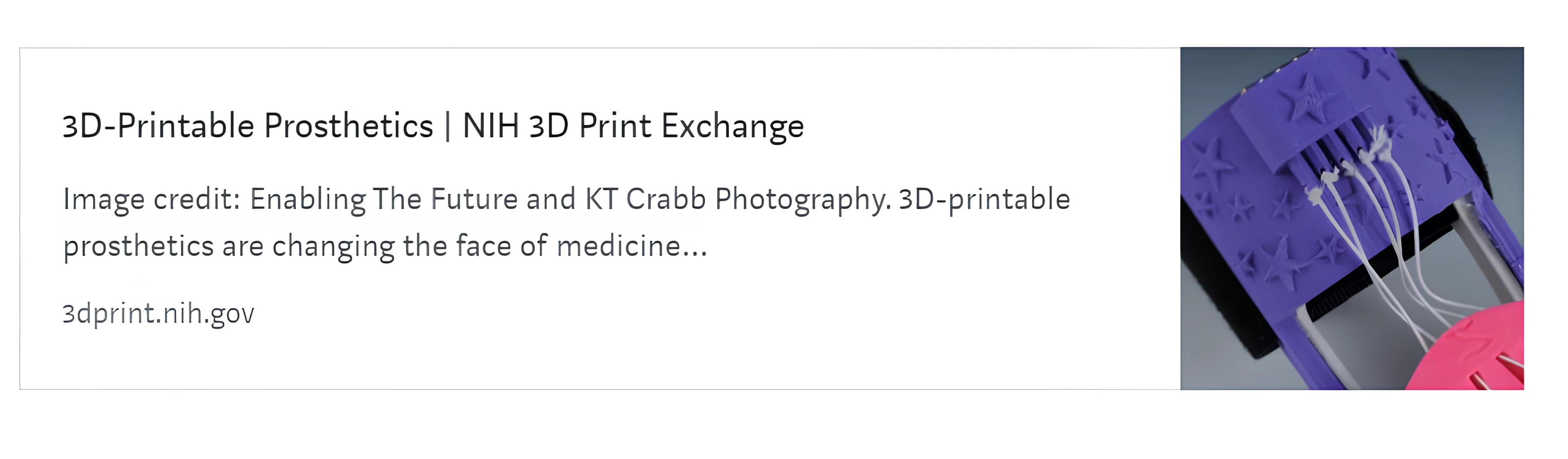 NIH 3D Print Exchange prosthetics